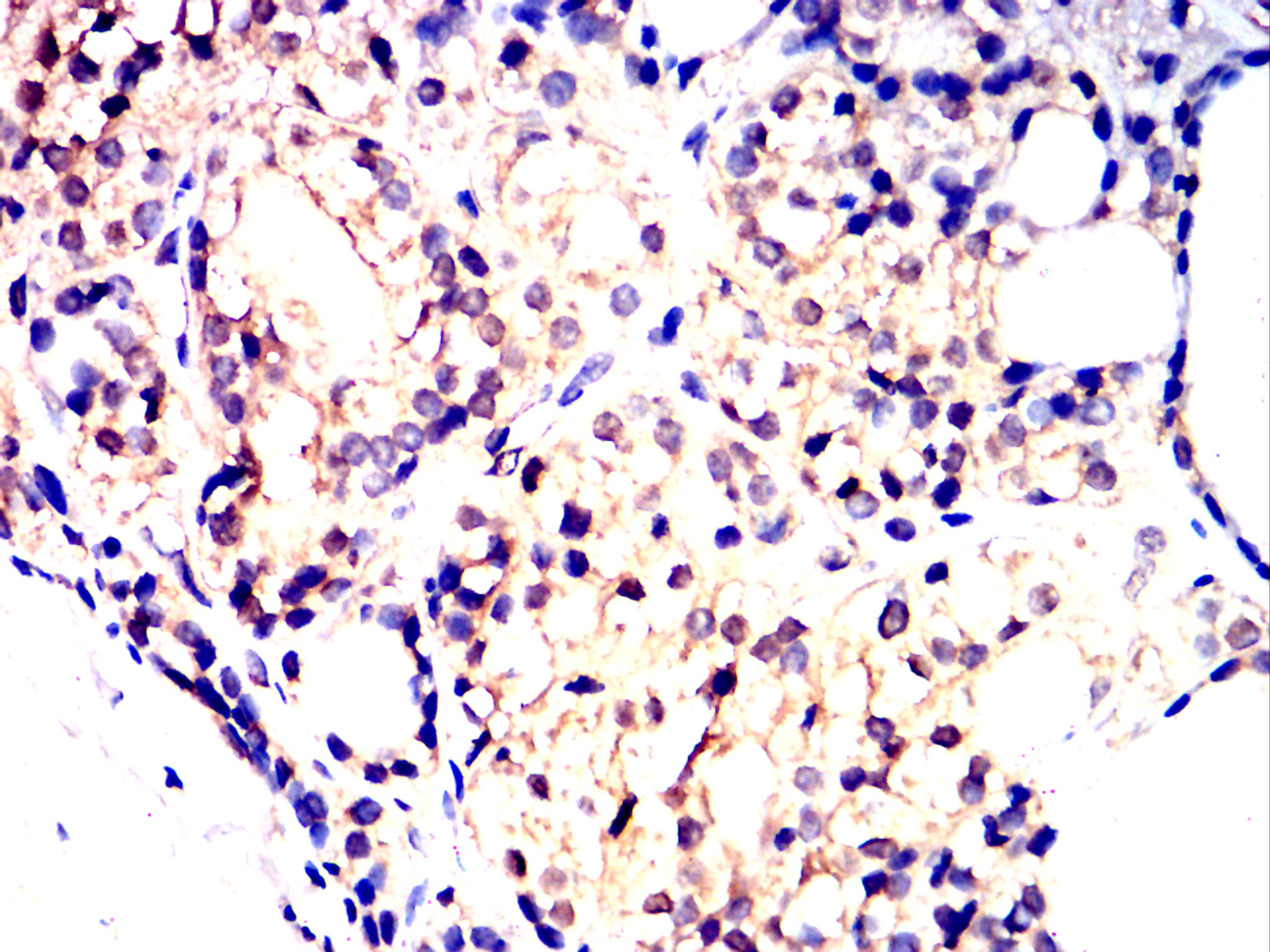 IHC